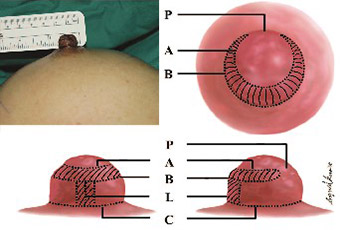 Vectra-3D-Breast-Imaging-System