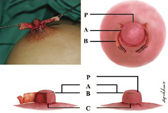 Vectra-3D-Breast-Imaging-System