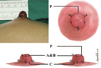 Vectra-3D-Breast-Imaging-System